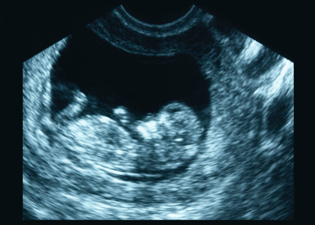 Gender selection in the fetus  stage